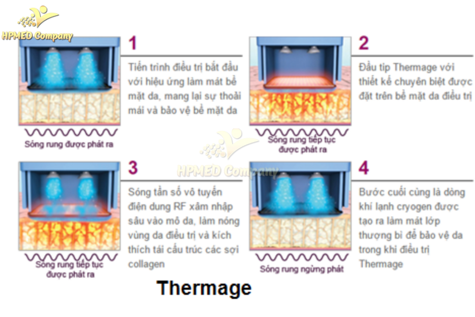 Công nghệ Thermage