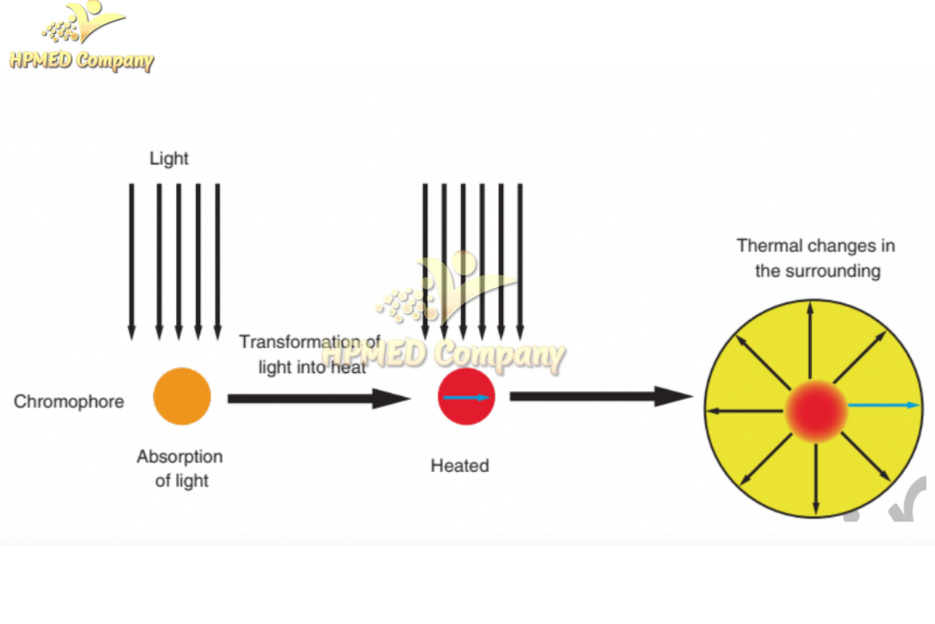Nám quang nhiệt laser