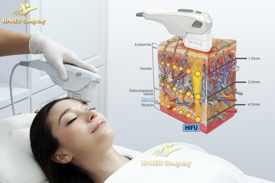 Nguyên lý hoạt động của máy trẻ hóa da HIFU