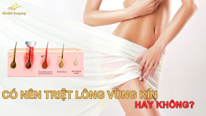triệt lông vùng kín là gì ? có những phương pháp nào ? những lưu ý quan trọng ?