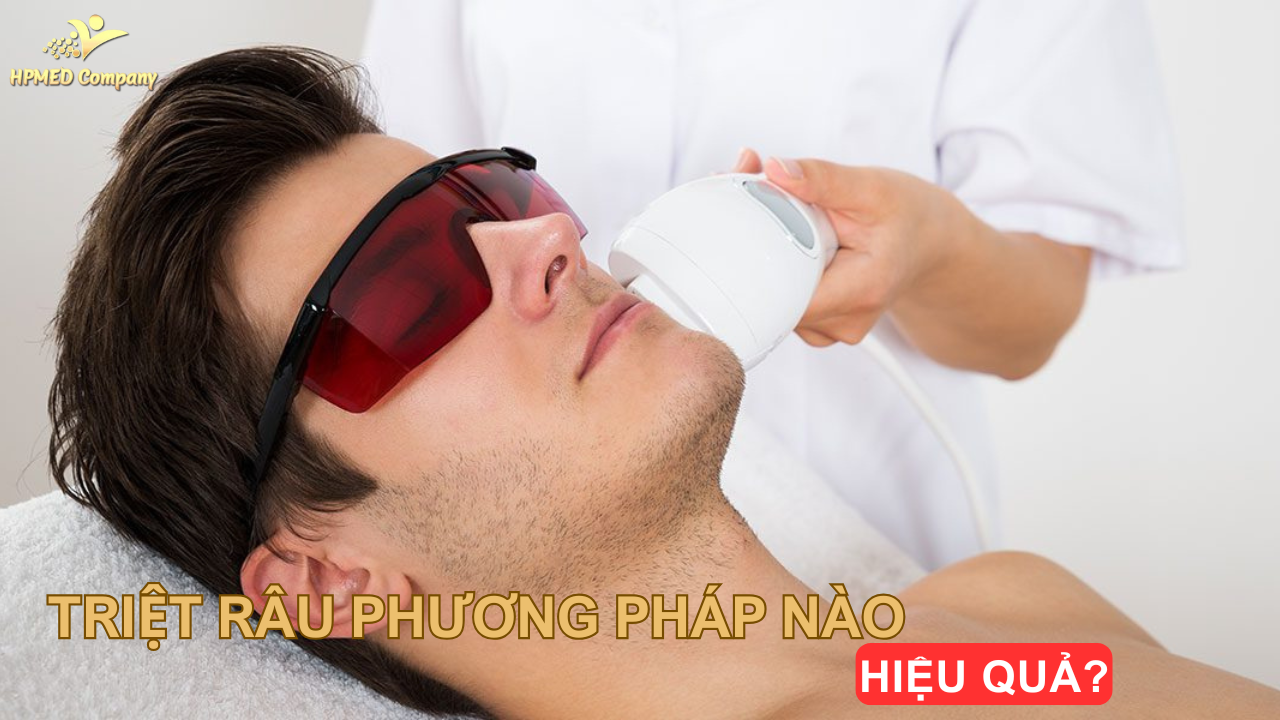 Giới thiệu về triệt râu