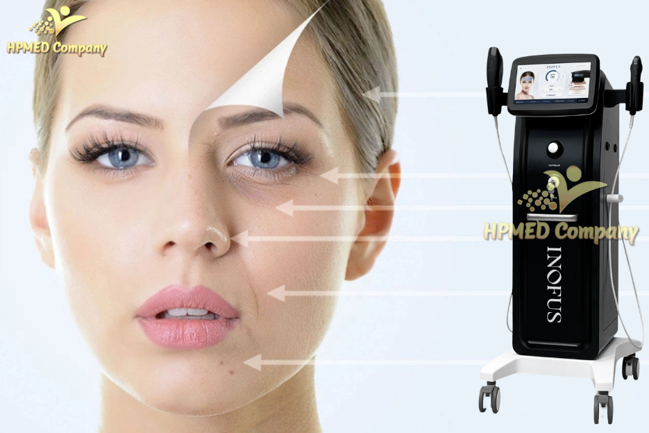  Máy Xóa Nhăn Công nghệ HIFU