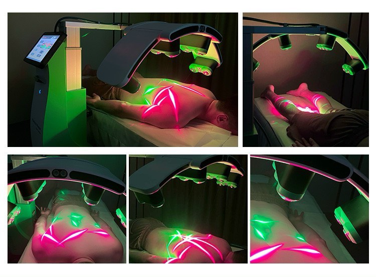 MAY GIAM BEO LUXMASTER SLIM LASER 532NM 13