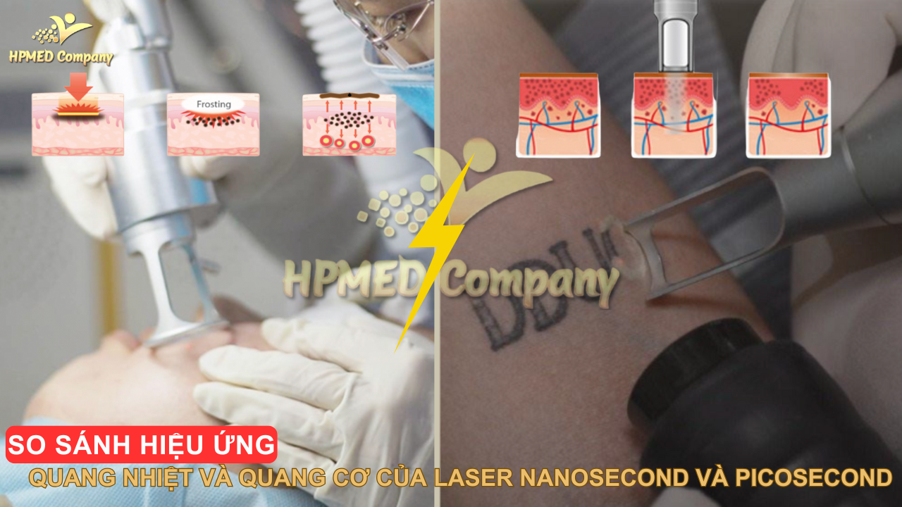 So sánh hiệu ứng Quang nhiệt và Quang cơ của Laser Nanosecond và Picosecond