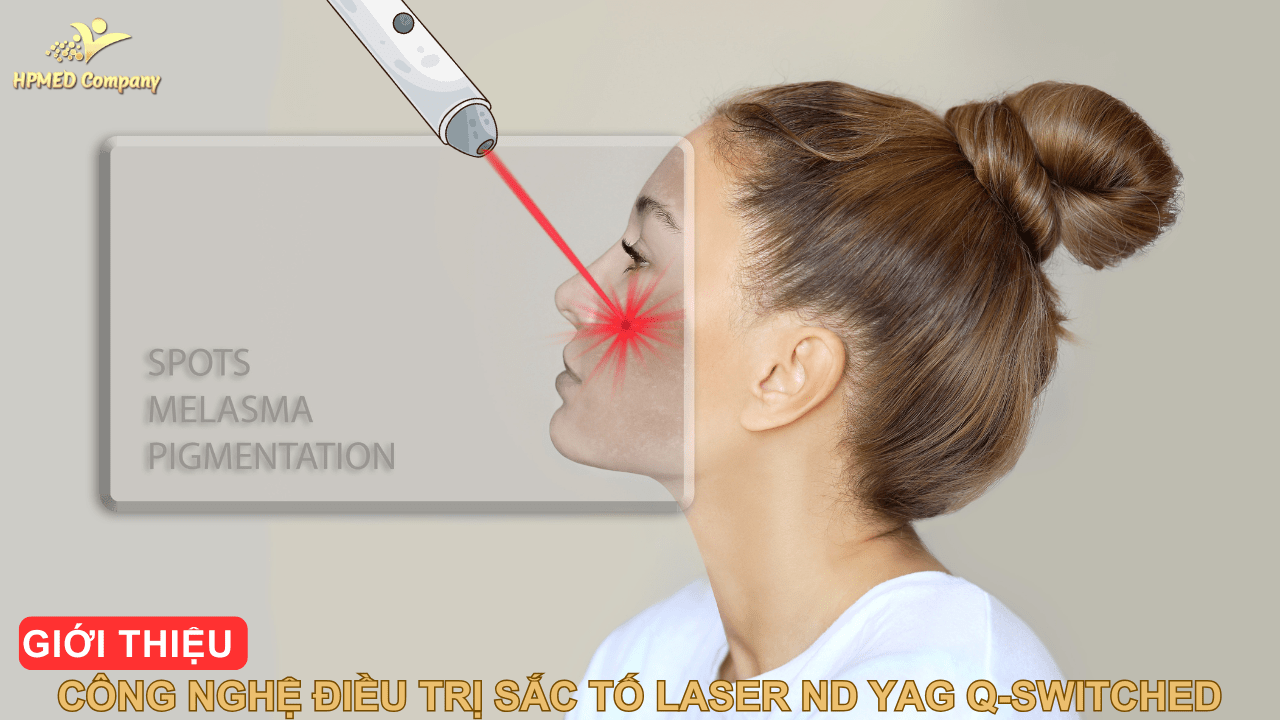 Giới Thiệu Công Nghệ Điều Trị Sắc Tố Laser ND YAG Q-Switched