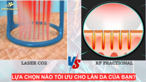 So sánh Công nghệ RF Fractional và Laser CO2 Fractional