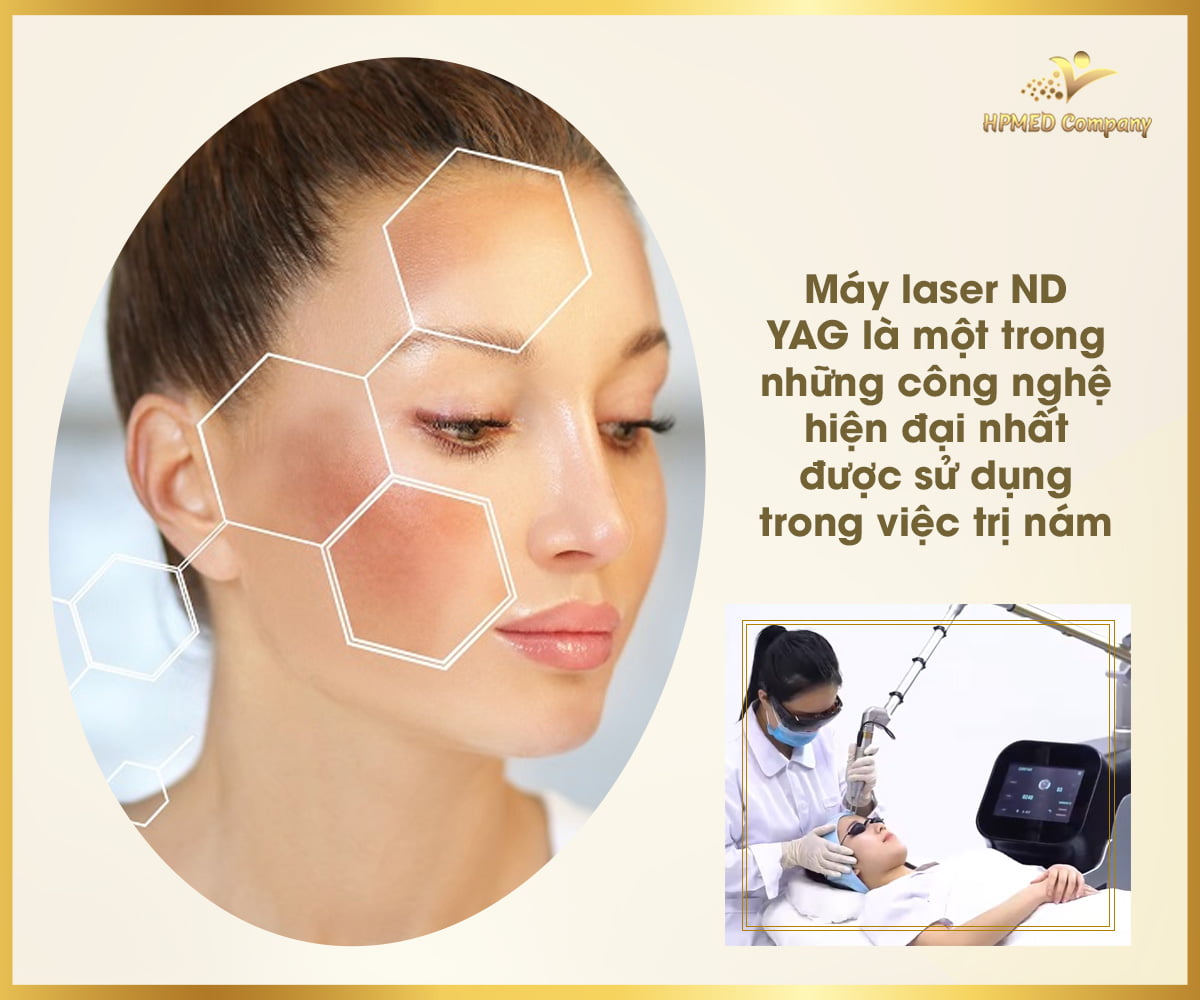 Hướng dẫn sử dụng máy laser nd yag trị nám hiệu quả nhất!