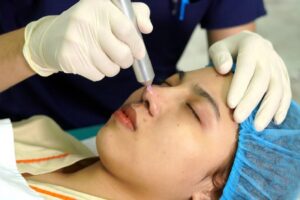 Plasma lạnh là gì? Tia plasma lạnh có tác dụng gì?