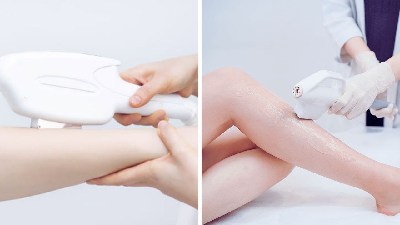 spa triệt lông là gì ? địa chỉ spa triệt lông nào tốt