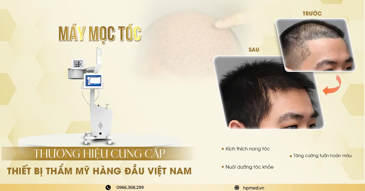 Máy Mọc Tóc