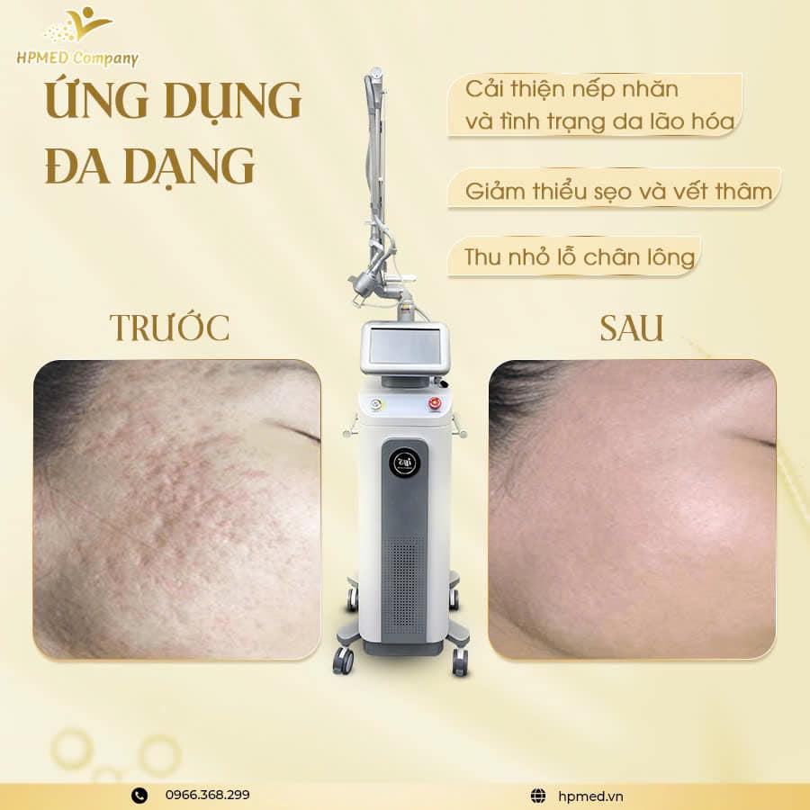 Máy Trị Sẹo Laser Co2 Fractional Prismxel Hàn Quốc