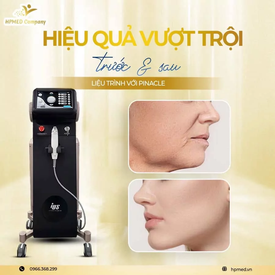 Máy Rf Vi Điêm Pinacle IDS Hàn Quốc