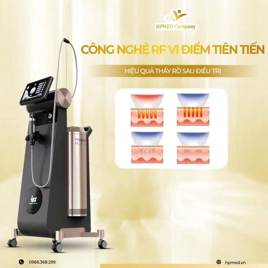 Máy Rf Vi Điêm Pinacle IDS Hàn Quốc