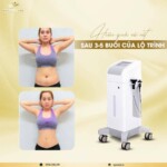 Máy Giảm Béo Cavitation RF BL H10 | Cao Cấp Thượng Hải