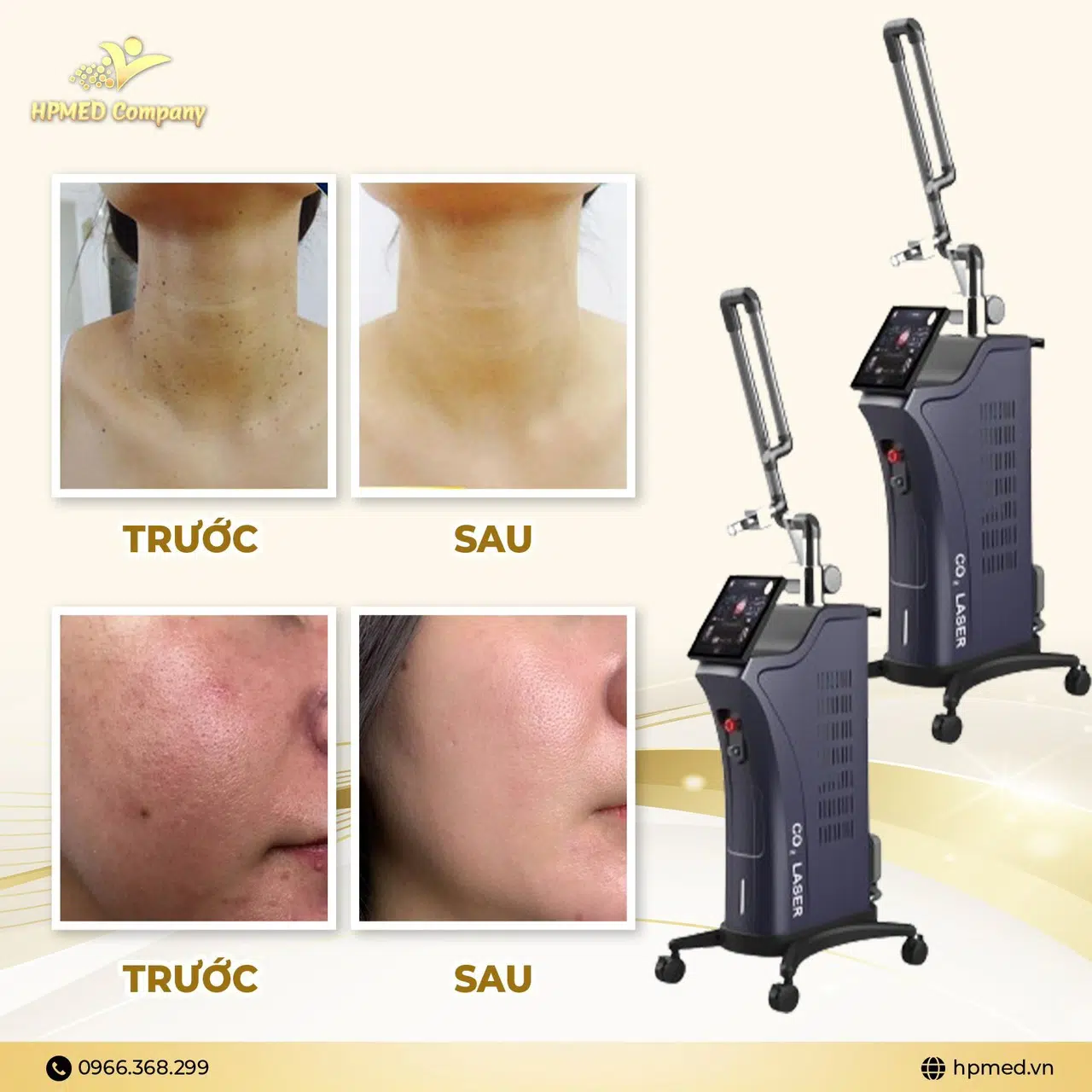 Sửa Chữa Máy Laser Co2 Fractional Tại Gia Lai Kinh Nghiệm và Kiến Thức