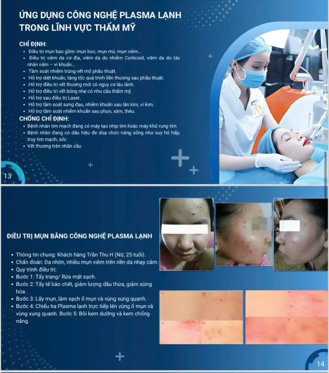 máy plasma lạnh plasma rosy - 17