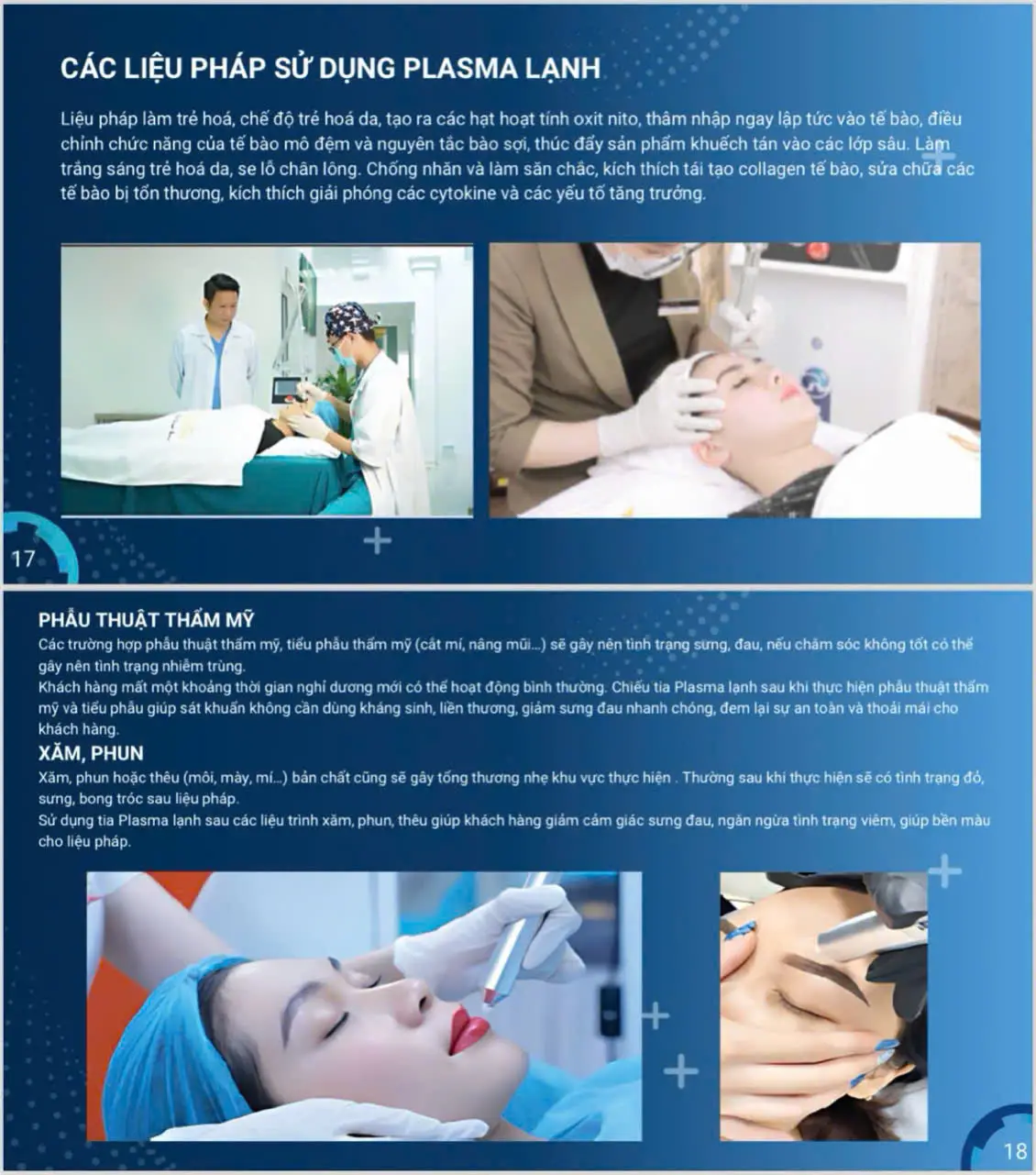 máy plasma lạnh plasma rosy - 19