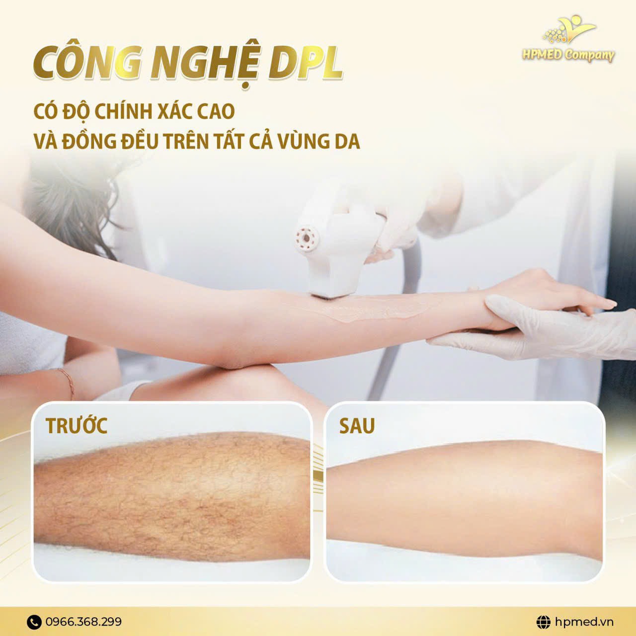 Thay Bóng Xung Máy Triệt Lông Tại Quảng Bình Kinh Nghiệm, Chuyên Môn Và Niềm Tin