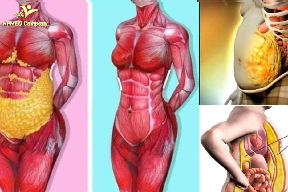 Mỡ nội tạng là gì? Tác hại ra sao?