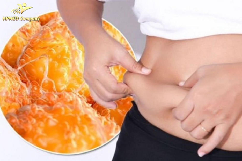 Mỡ nội tạng là gì và tại sao nguy hiểm?
