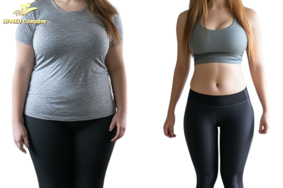 Giảm béo không phẫu thuật phù hợp với ai?