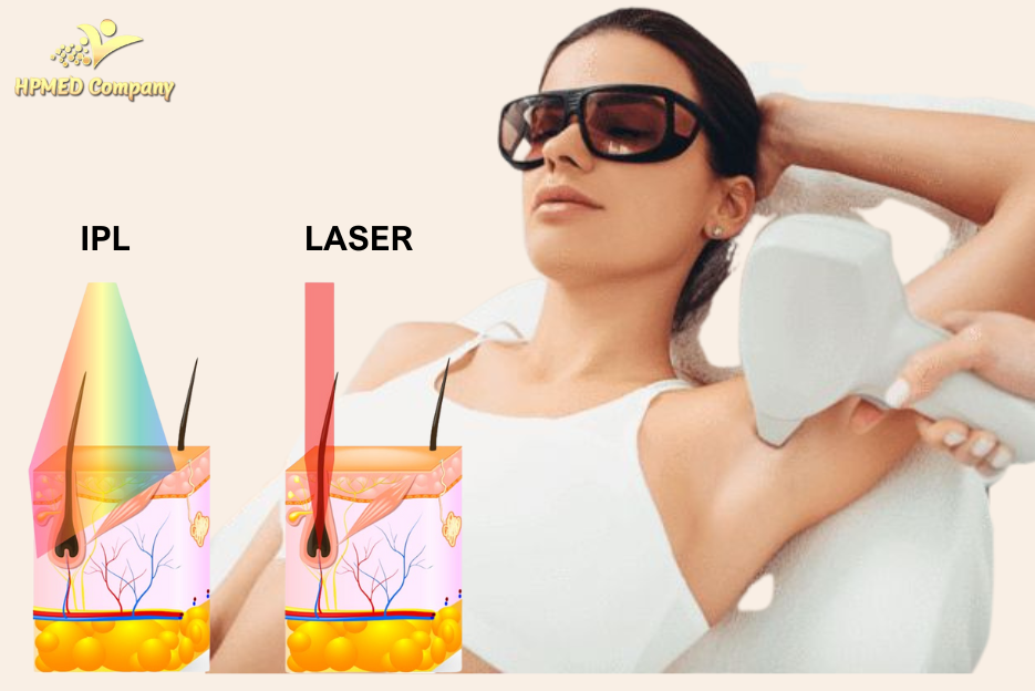 Các phương pháp khác triệt long lại spa