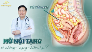 Mỡ nội tạng là gì ? nguyên nhân hình thành và cách giảm mỡ nội tạng
