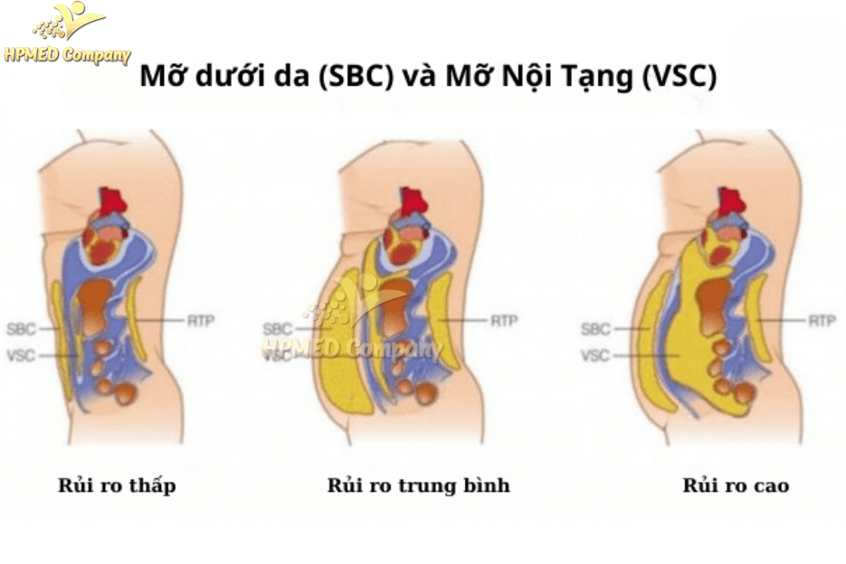 mỡ nội tạng và mỡ dưới da là gì ? nguyên nhân hình thành và cách giảm mỡ nội tạng và mỡ dưới da 2 Phân biệt mỡ nội tạng và mỡ dưới da