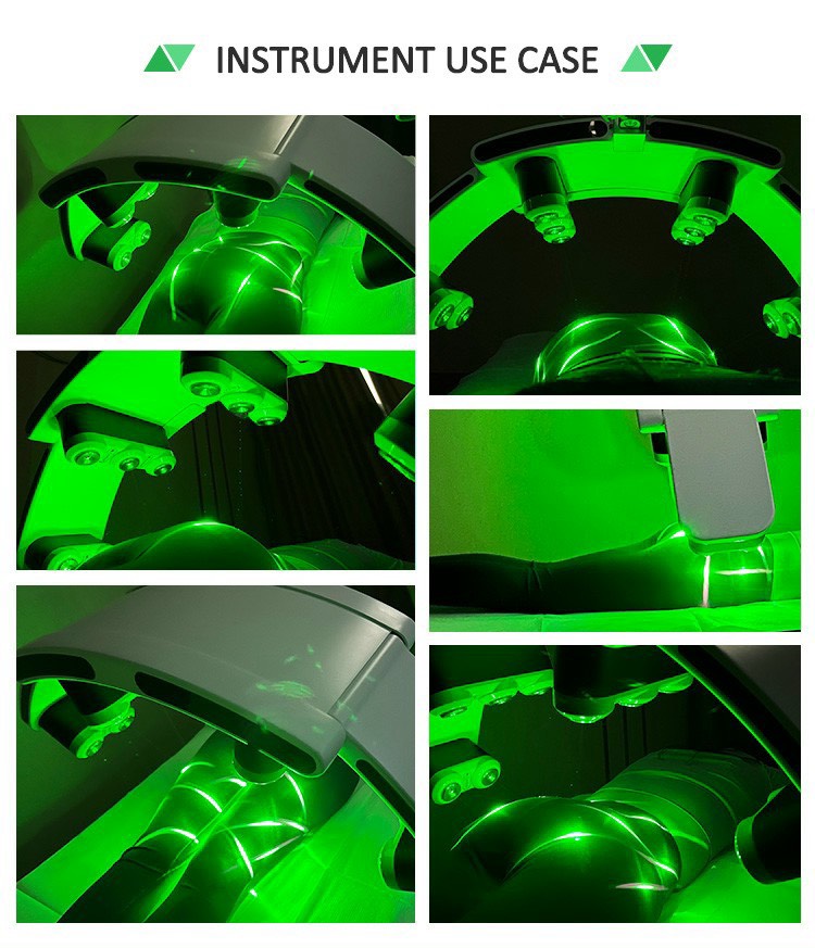 MAY GIAM BEO LUXMASTER SLIM LASER 532NM 12