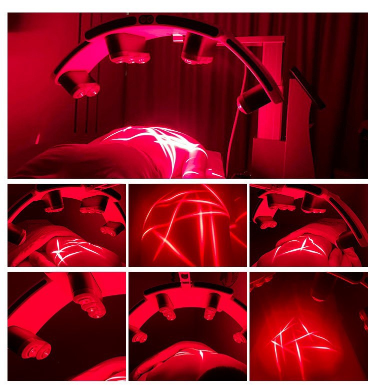 Công Nghệ Giảm Béo Laser 532nm - Nguyên lý hoạt động và ưu điểm ? 4 MAY GIAM BEO LUXMASTER SLIM LASER 532NM 14