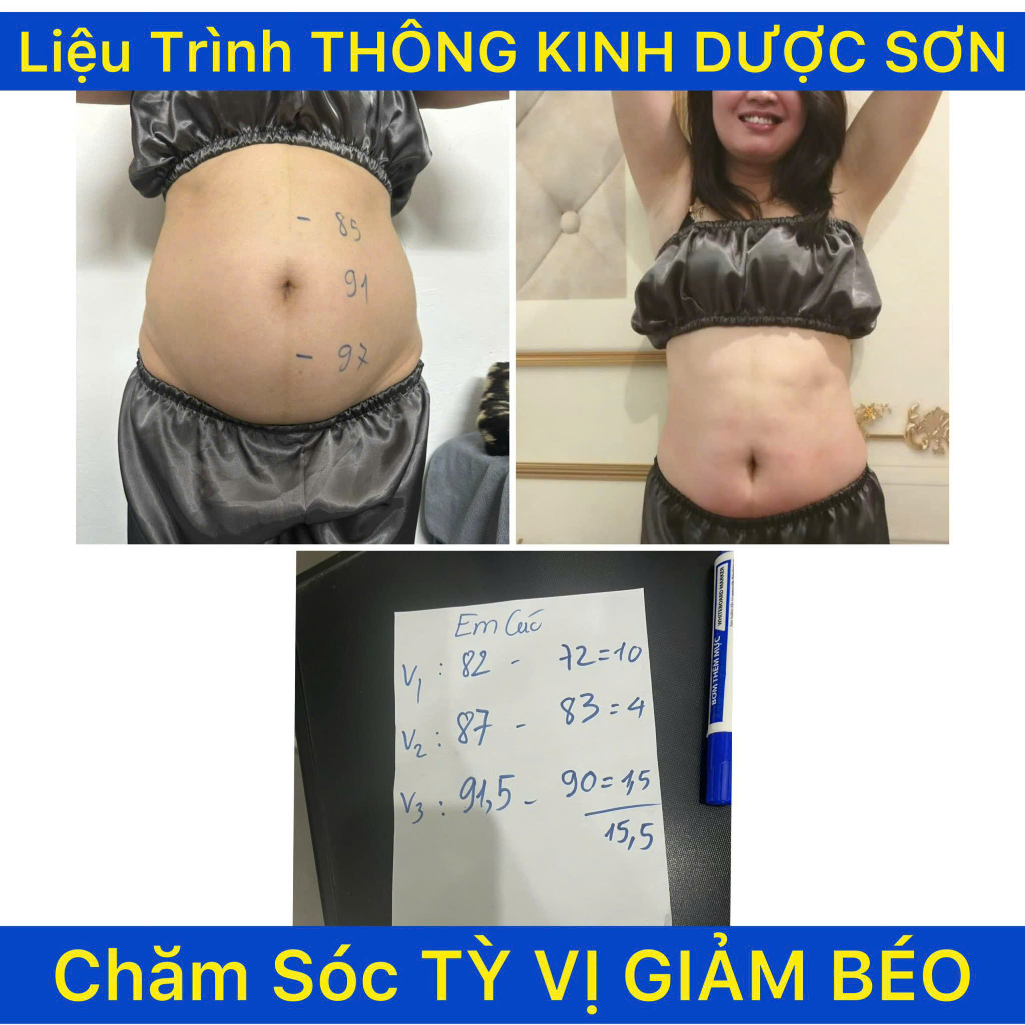 Máy điện sinh học trị liệu: Cẩm nang toàn diện về công nghệ và ứng dụng 7 May Dien Sinh Hoc DDS 05 3