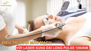 Giới Thiệu Công Nghệ Điều Trị Giãn Mao Mạch Laser Xung Dài Long Pulse 1064nm