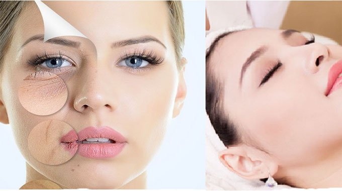 Spa trị nám ? Top 5 Lợi ích khi trị nám tại spa