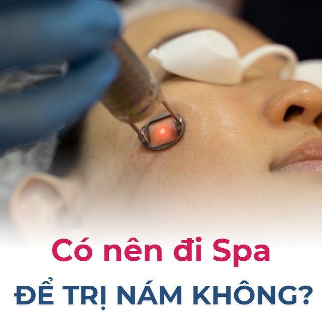 Spa trị nám ? Top 5 Lợi ích khi trị nám tại spa 4 Spa trị nám ? Top 5 Lợi ích khi trị nám tại spa