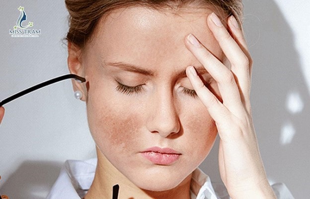 Spa trị nám ? Top 5 Lợi ích khi trị nám tại spa 2 Spa trị nám ? Top 5 Lợi ích khi trị nám tại spa