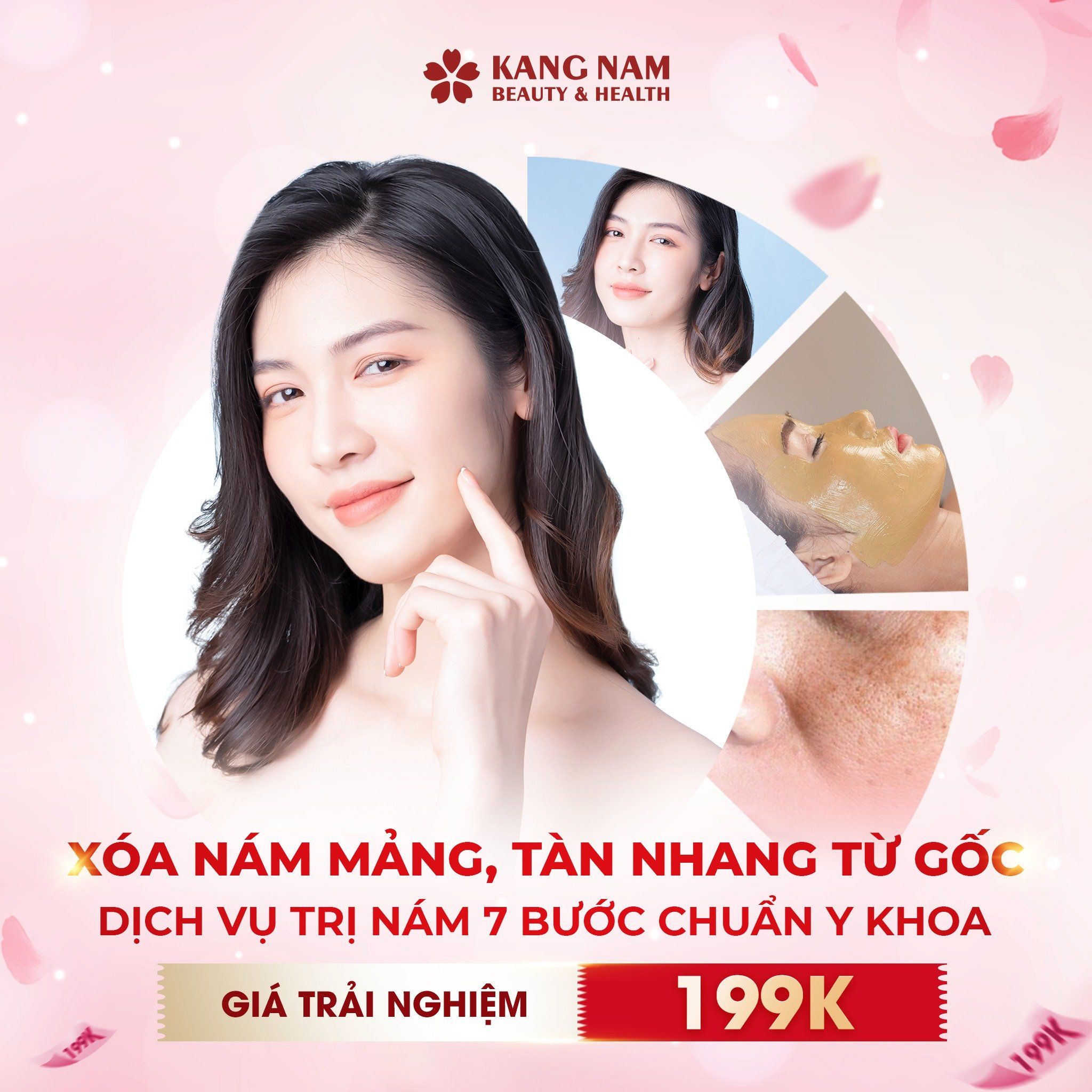 Spa trị nám ? Top 5 Lợi ích khi trị nám tại spa 7 Spa trị nám ? Top 5 Lợi ích khi trị nám tại spa