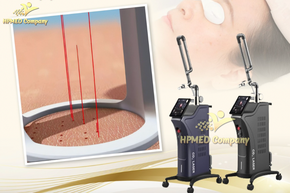 Đầu Tư Để Nhanh Thu Hồi Vốn: Nên Chọn Laser CO2 Fractional Hay Laser Nd YAG Trước? 4 Công nghệ Laser co2 fractional