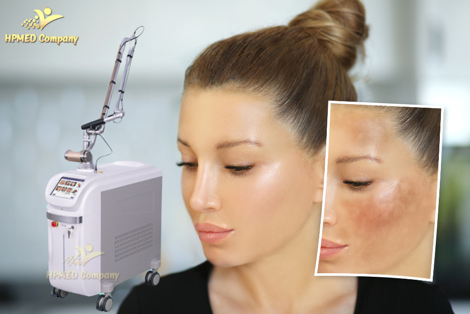 Đầu Tư Để Nhanh Thu Hồi Vốn: Nên Chọn Laser CO2 Fractional Hay Laser Nd YAG Trước? 5 Laser Nd YAG
