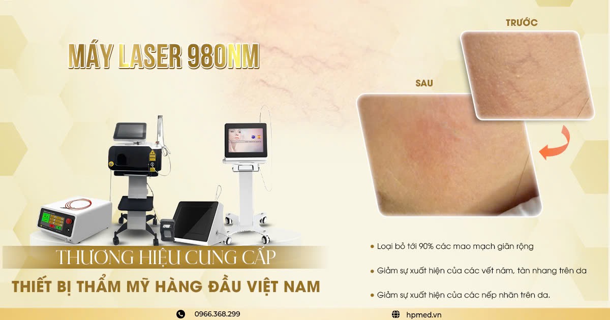 Máy Điều Trị Giãn Mao Mạch