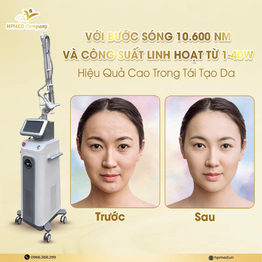 Đối Tượng Nên sử Dụng Máy Laser Co2 Fractional Prismxel