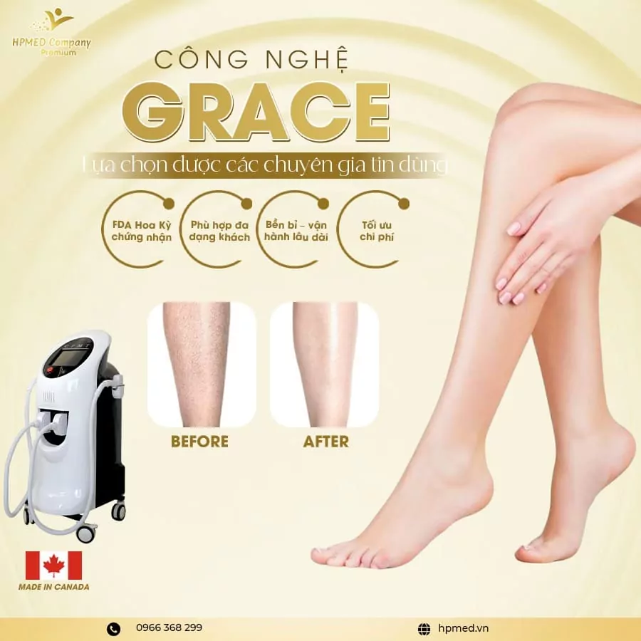 Máy Triệt Lông Diode Laser Cao Cấp