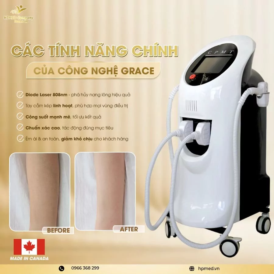 Máy Triệt Lông Diode Laser Cao Cấp