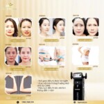 Máy Hifu INOFUS Nâng Cơ Trẻ Hóa | Cao Cấp Hàn Quốc