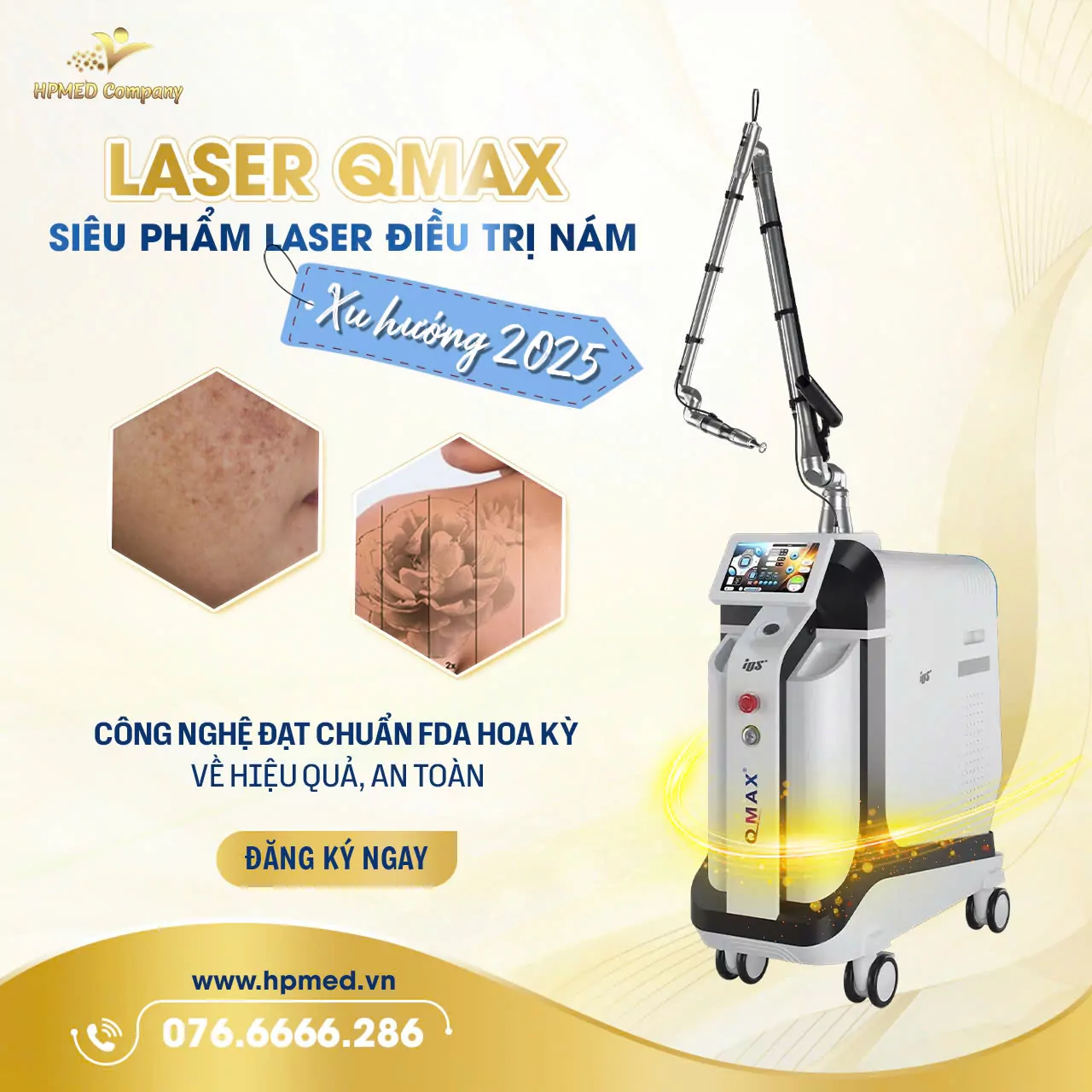 Máy Laser ND YAG QSwitch QMAX