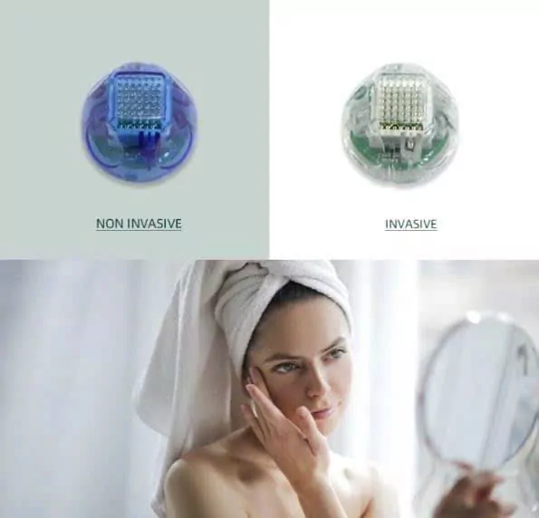 Máy RF Vi Kim Quanstu Cao Cấp Bắc Kinh